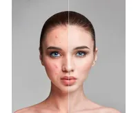 Wellneo Vakuový čistič pórů (3)